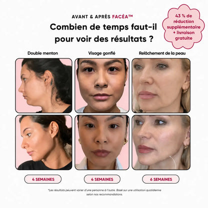 Facéa™ – Sculpteur de visage sans chirurgie