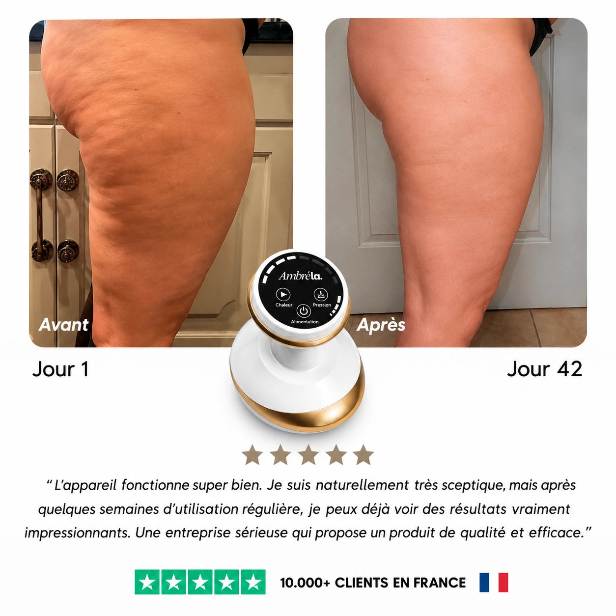 CelluLisse™ - Appareil de massage