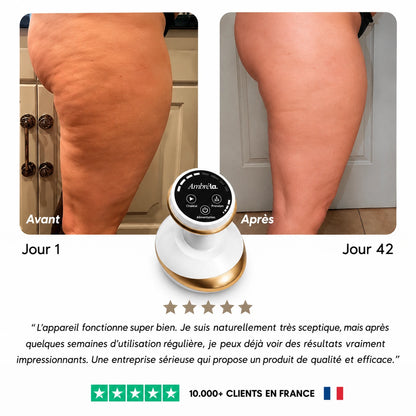 CelluLisse™ - Appareil de massage