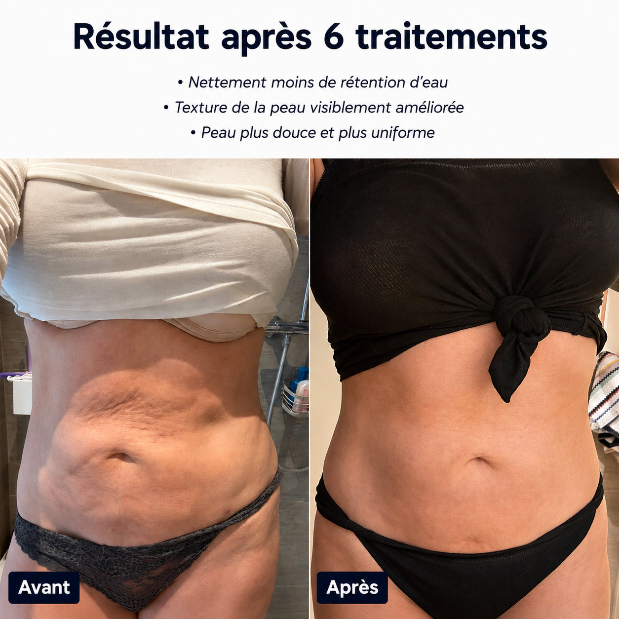 CelluLisse™ - Appareil de massage