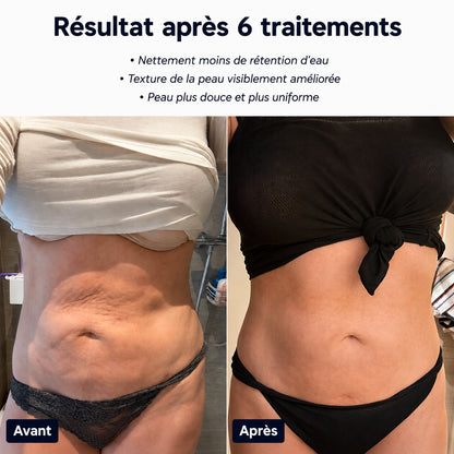 CelluLisse™ - Appareil de massage