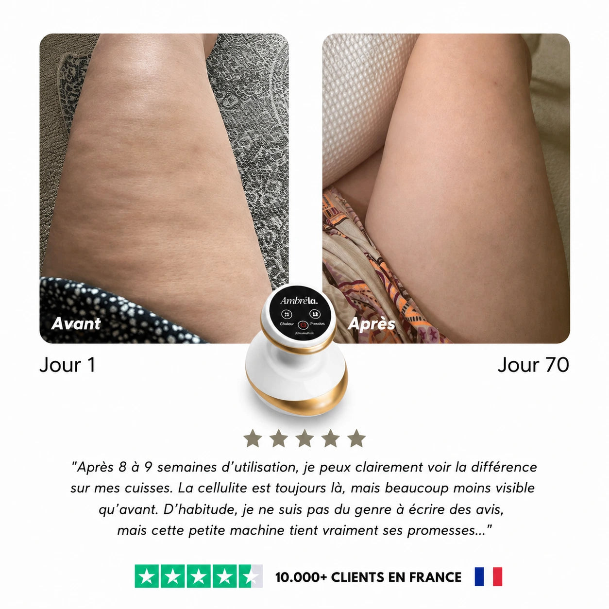 CelluLisse™ - Appareil de massage