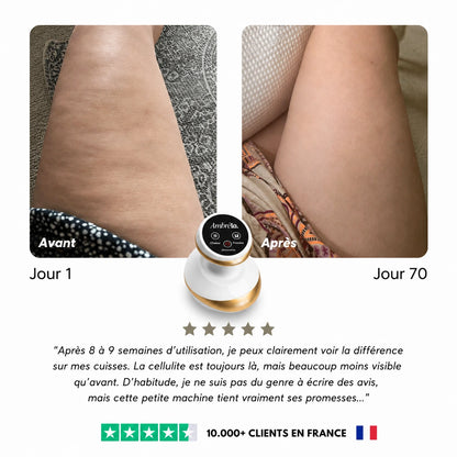 CelluLisse™ - Appareil de massage
